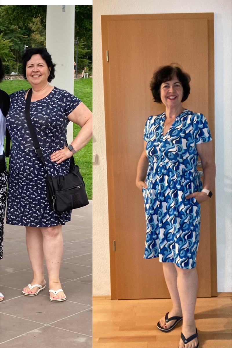 Elke Mölle — Vorher und Nachher